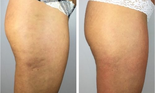 Resized_png_20211112_115940_0000