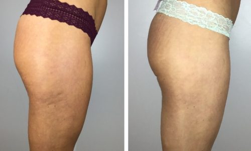 Screenshot_20210218-142427_Pic Stitch