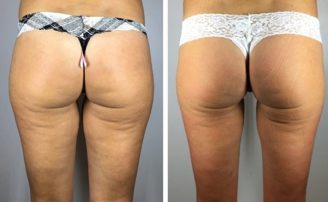 Screenshot_20211112-112429_Pic Stitch