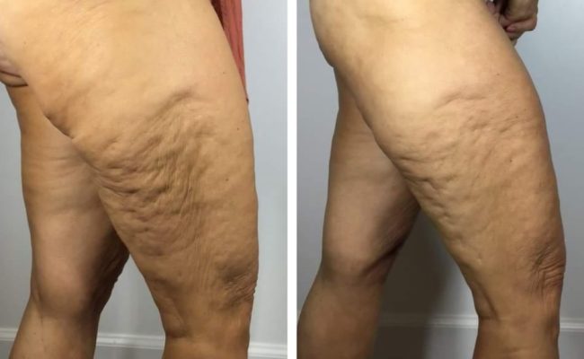 Screenshot_20221129-151953_Pic Stitch