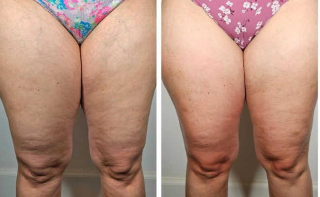 Screenshot_20240516_064046_Pic Stitch