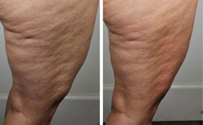 Screenshot_20240516_064302_Pic Stitch